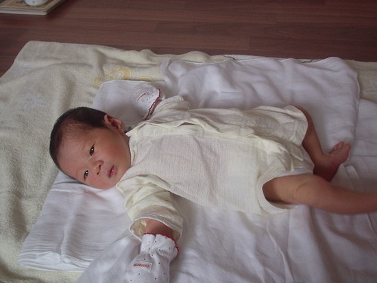 오늘 아침에 꽝해서 멍들었어요 T.T