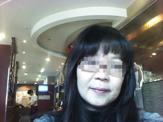 얼굴 리프팅 받았어요ㅎ