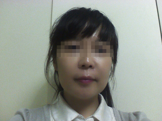 얼굴 리프팅 받았어요ㅎ