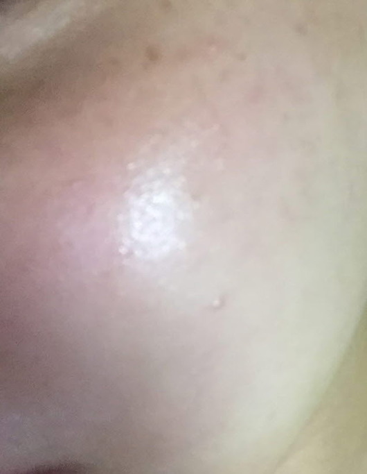 피부때문에 스트레스였는데 팩하니까 많이 좋아졌어요 ㅠ