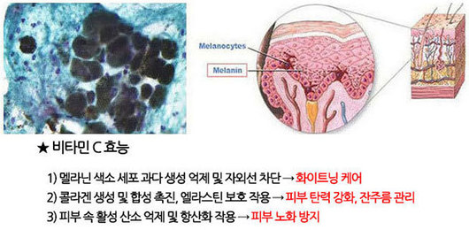 지긋지긋 기미 관리의 해답!!!!