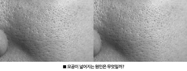 컨텐츠이미지