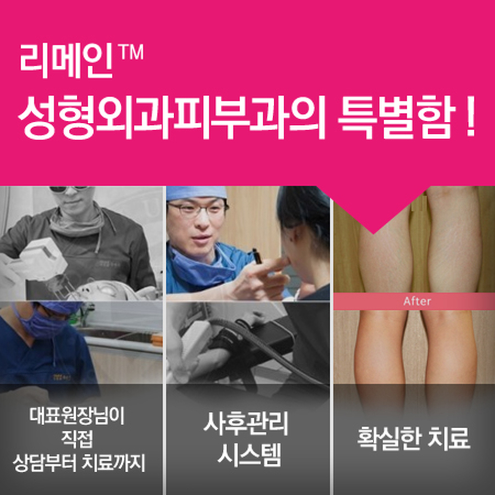 신사임신튼살