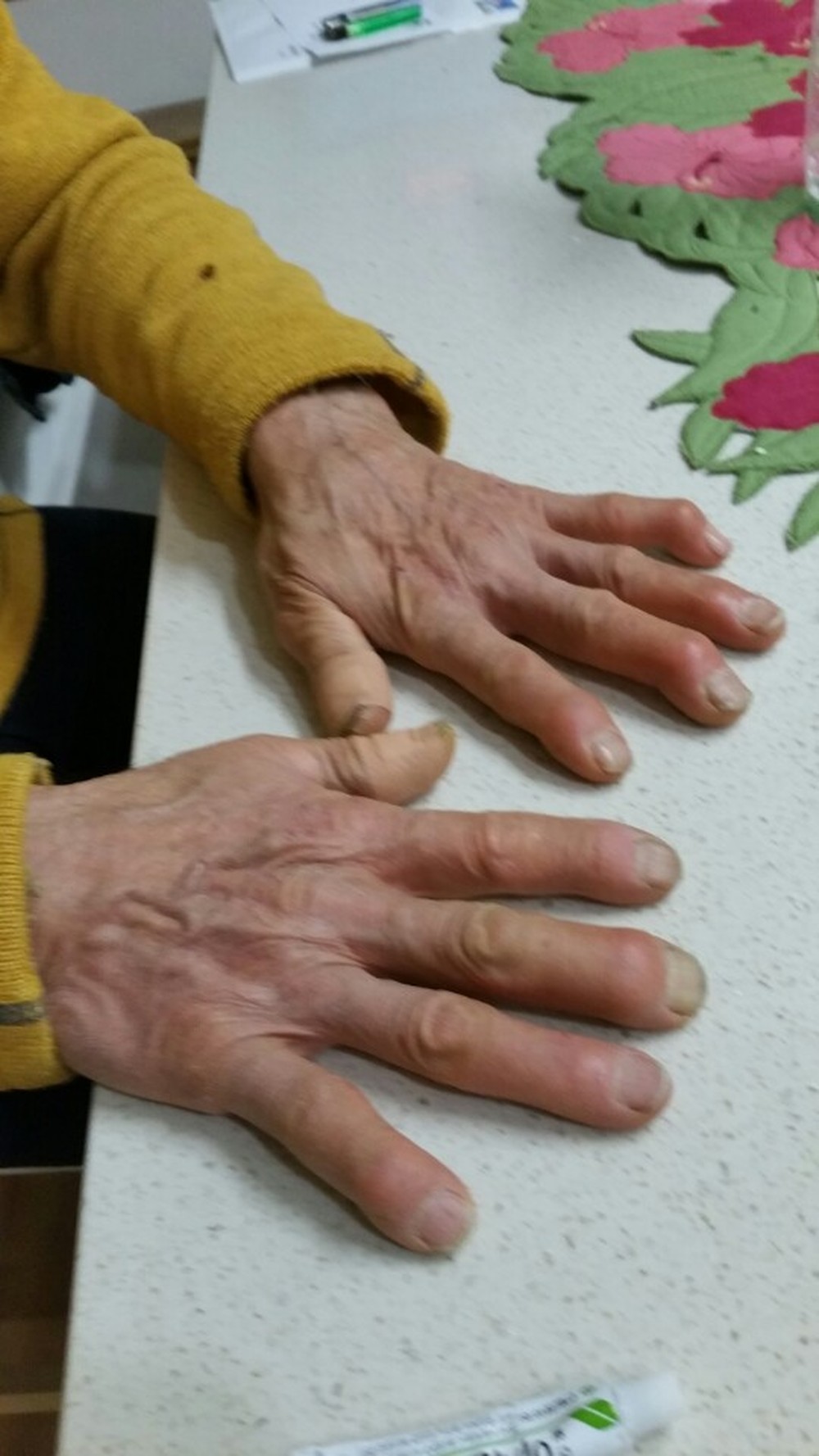 아빠손이예요
