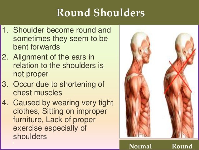 라운드숄더, 거북목 해..