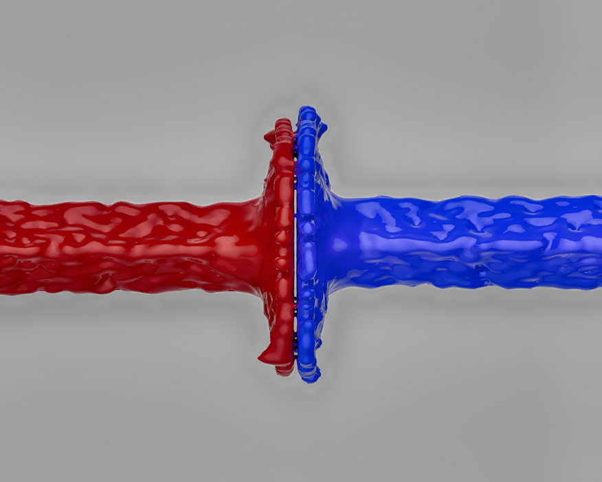 상법 개정안과 노란봉투..